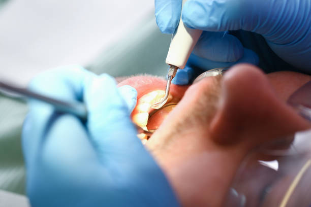 Best Dentist Open Late Near Me  in Greenfield, OH