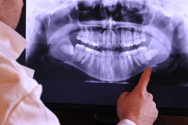 Best Chipped Tooth Repair Near Me  in Greenfield, OH