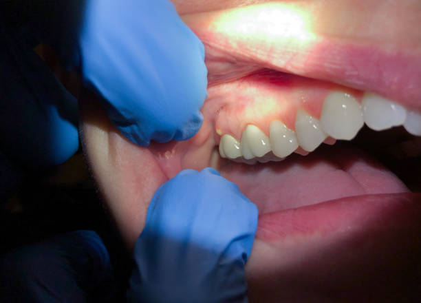 Dentist for Dental Trauma in OH