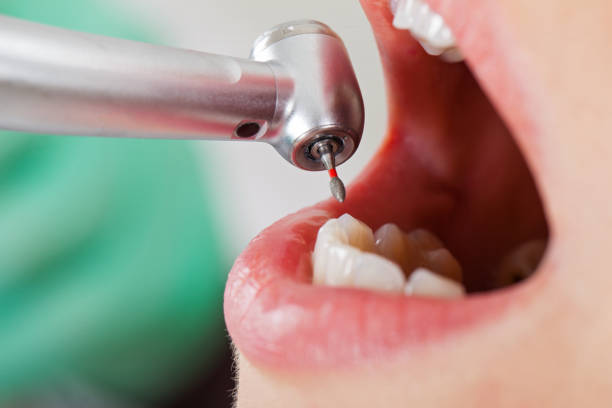 Best Root Canal Emergency Dentist  in Greenfield, OH